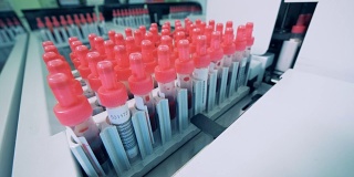 很多带血的瓶子，靠近点。在一家诊所，一种特殊的机器在试管中检测血液样本。