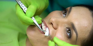 牙医将棉卷放在病牙附近，与唾液隔离，靠近