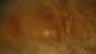 食物上的霉菌菌落。宏视频拍摄视频素材模板下载