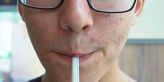 一个脸上长了粉刺的年轻人用吸管喝汽水。