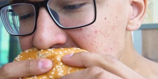 一个脸上长痘痘的年轻人在吃汉堡包。